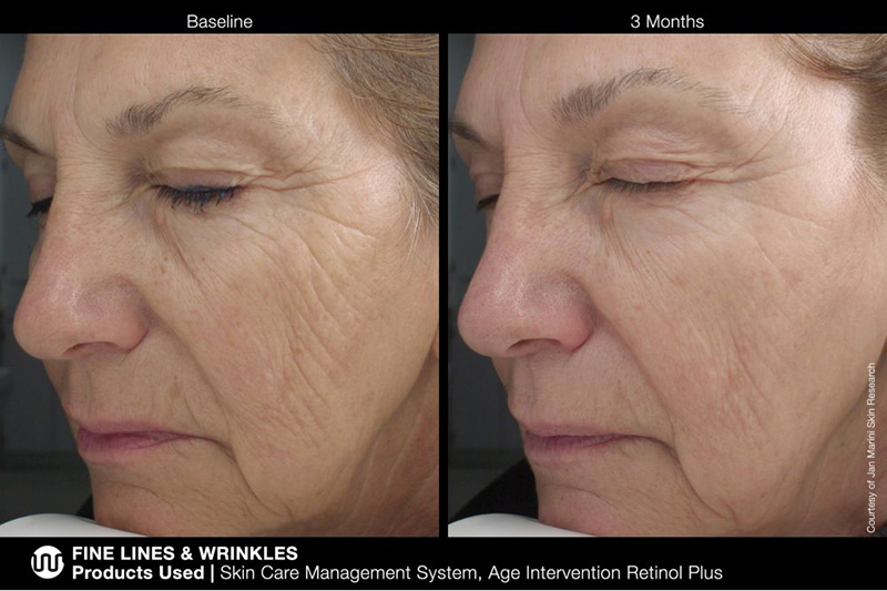 Marini SkinSolutions Retinol Plus Przeciwstarzeniowy krem z retinolem 28 g