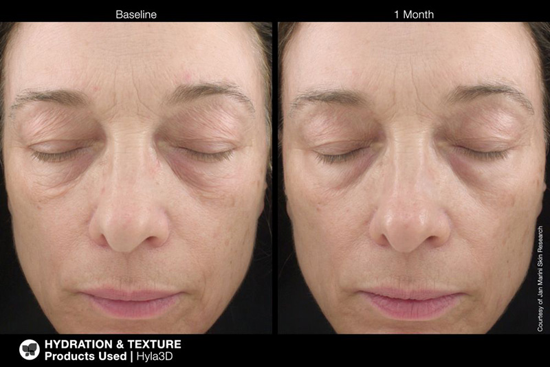 Marini SkinSolutions Hyla3D® Face Serum Serum rewitalizujące 30 ml