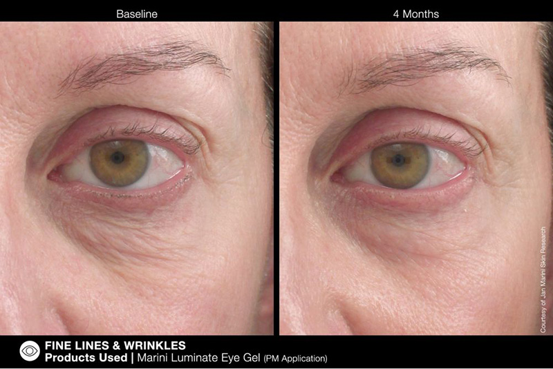 Marini SkinSolutions Marini Luminate Eye Gel Żel rozjaśniający do pielęgnacji okolic oczu 15 ml