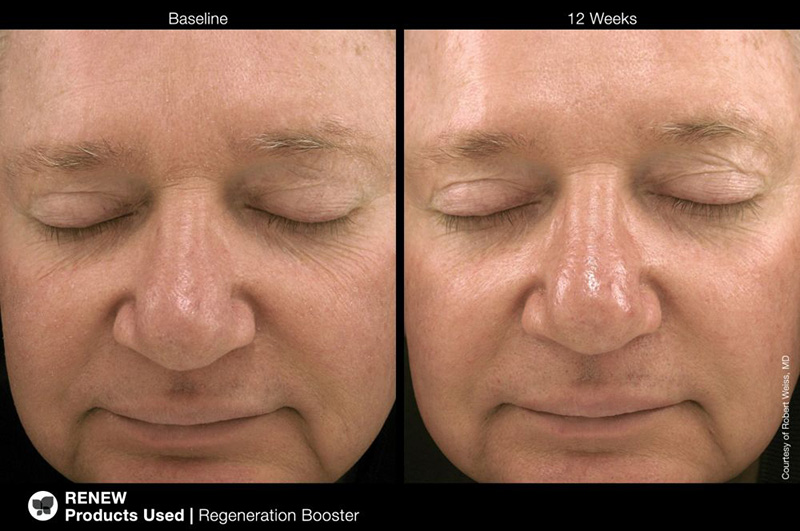 Marini SkinSolutions Regeneration Booster Booster regenerujący 30 ml