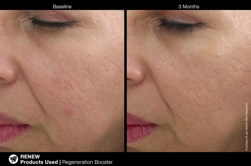 Marini SkinSolutions Regeneration Booster Booster regenerujący 30 ml
